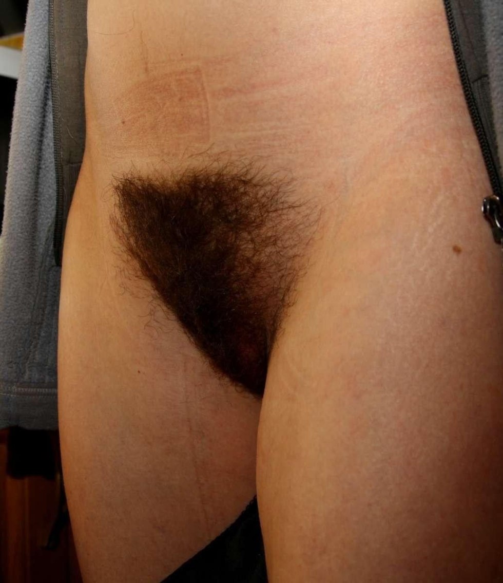 Female pubic hair