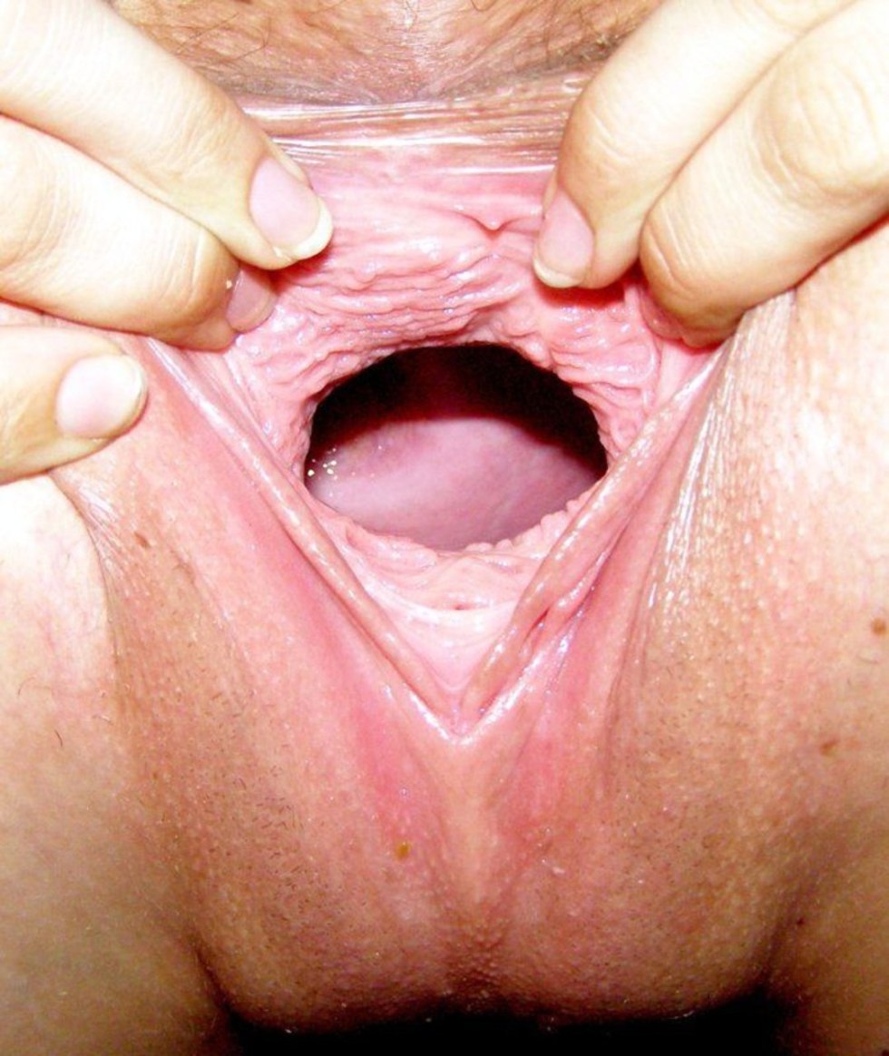 The structure of the female vagina